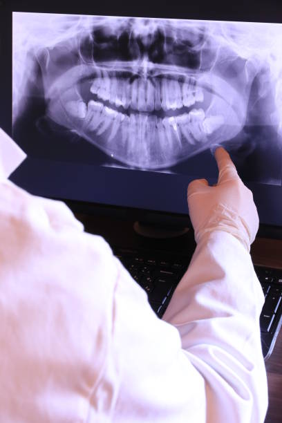 Best Emergency Dentist for Knocked-Out Tooth in Cortland, OH
